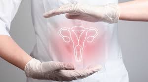 Gynecologic 
