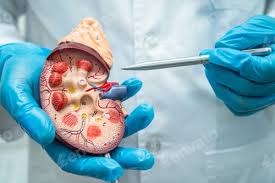 Urologic 